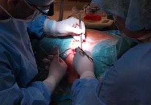 Transplantace jater a jaterní dialýza