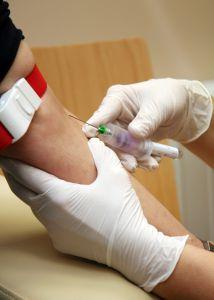 Vysoká hladina kyseliny močové v krvi předurčuje vznik ledvinových kamenů