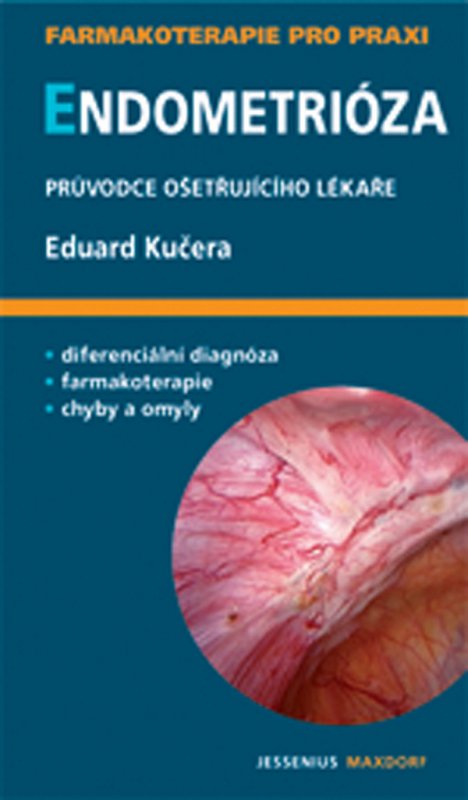 Endometrióza příznaky a co všechno byste měli vědět?