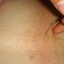 Akupunktura uvolňuje energetické bloky a vrací tělo do přirozené rovnováhy