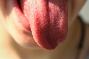 Povlak na jazyku může signalizovat řadu onemocnění, včetně rakoviny