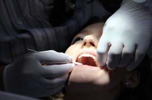 zuby, zdraví, zubní lékař, zubní hygiena
