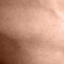 Zhoubné nádory kůže - melanom, bazaliom a jejich léčba